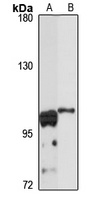 IFT88 Rabbit Polyclonal Antibody