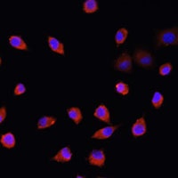 Anti-IFT88 Antibody