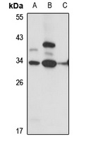 IGSF6 Antibody