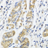 Anti-IL-11 Antibody