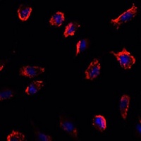 Anti-IL-11 Antibody