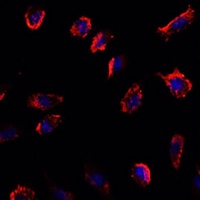 IL-11 antibody