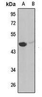 IL-11RA Rabbit Polyclonal Antibody