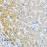 IL-20 antibody