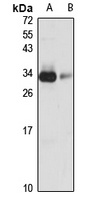 ING4 Rabbit Polyclonal Antibody