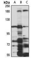 INPP5B Rabbit Polyclonal Antibody