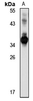 INSIG-1 Rabbit Polyclonal Antibody