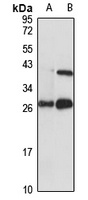 INSIG2 Antibody