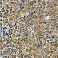 Anti-INSIG2 Antibody