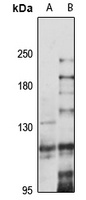 INTS8 Antibody