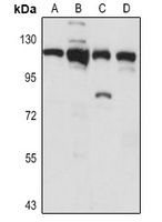 Importin-11 Rabbit Polyclonal Antibody