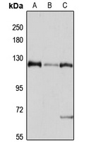 RanBP4 Antibody