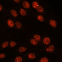 Anti-RanBP8 Antibody