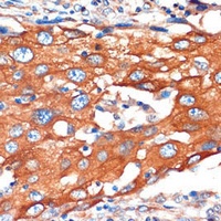 Anti-IQGAP2 Antibody