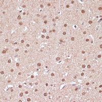 Anti-ITCH Antibody
