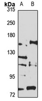 Integrin alpha 11 Rabbit Polyclonal Antibody