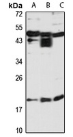CENPR Rabbit Polyclonal Antibody