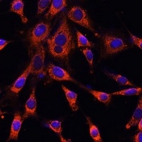 Anti-ITPR3 Antibody