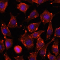Anti-ITSN2 Antibody