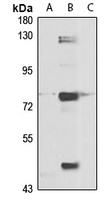 IVNS1ABP Rabbit Polyclonal Antibody
