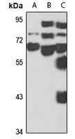 KBTBD7 Antibody