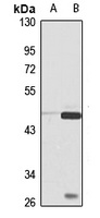 Kir3.2 Rabbit Polyclonal Antibody