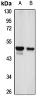 Kir6.1 Rabbit Polyclonal Antibody
