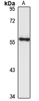 KCNK4 Rabbit Polyclonal Antibody