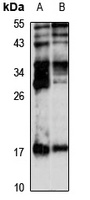 KCNMB1 Antibody