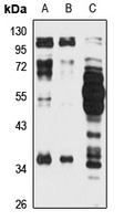 KCTD10 Rabbit Polyclonal Antibody