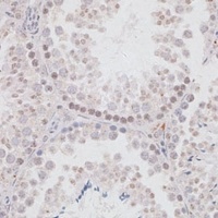 JMJD1A antibody