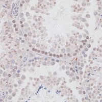 KDM3A Antibody