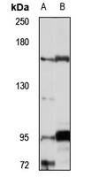 JMJD3 Rabbit Polyclonal Antibody