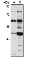 KIAA0513 Antibody