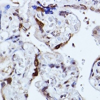 Anti-KIAA1429 Antibody