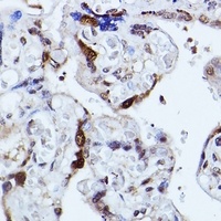 KIAA1429 antibody