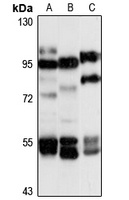 KIF19 Rabbit Polyclonal Antibody