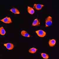 KIF21A antibody