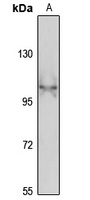 KIF5C Rabbit Polyclonal Antibody