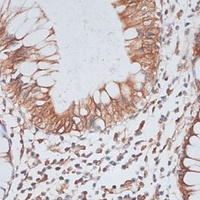 Anti-KIFC1 Antibody