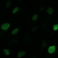 Anti-KIFC1 Antibody