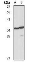 CD158a Rabbit Polyclonal Antibody