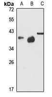 CD158d Rabbit Polyclonal Antibody