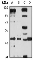 KIR3DL2 Antibody