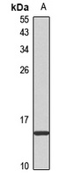 Kisspeptin-1 Rabbit Polyclonal Antibody
