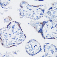 Kisspeptin-1 Rabbit Polyclonal Antibody