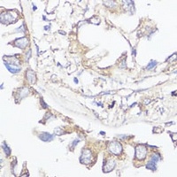 Klotho antibody