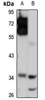 KLF1 Rabbit Polyclonal Antibody