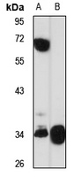 LKLF Rabbit Polyclonal Antibody