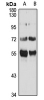 BTEB2 Rabbit Polyclonal Antibody